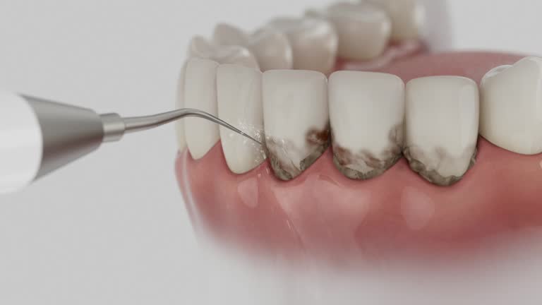 Reliable Dental Implants contractor in Sulphur, LA by Smile Center Dentistry